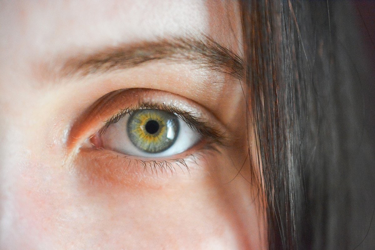 Жёлтый оттенок глаз