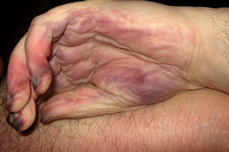 Таңертең ояндым, трусикам сперматозоидпен жабылған.