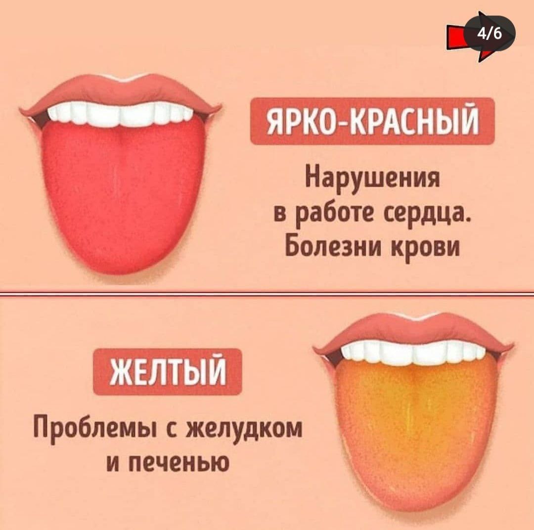 Здоровье по цвету языка
